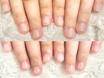 グラシナ 鳥丸店/爪の変化