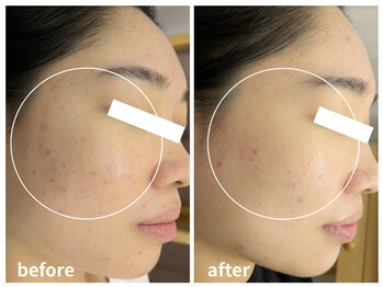 ラミーユ(La Miu)/