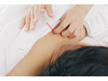 ほねつぎ 高津はりきゅう接骨院/～ 鍼灸 ～ 深部の筋肉に届く