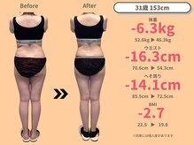 ニドム/31歳　-6kg産後痩身ダイエット3