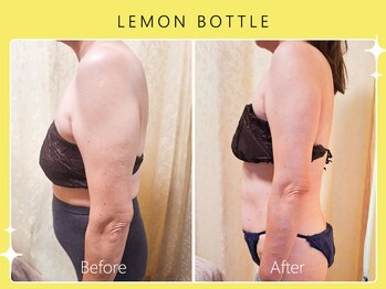 シロカネ イオンタウン西熊本店(SHIROKANE)/レモンボトル☆