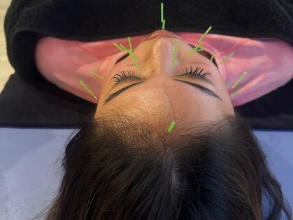 ビーワイ鍼灸整骨院 心斎橋院の写真