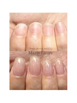 深爪矯正/自爪育成/ネイルケア