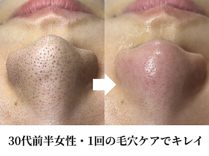 ティーツリー 名古屋 桜山(Tea Tree)の写真