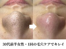 ティーツリー 名古屋 桜山(Tea Tree)