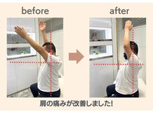 フィクシブ 上野(FIXIBE)/肩が挙がるように！