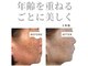 ユニクリア 佐賀(Uniclear)の写真/大人肌の【ハーブピーリング】美白・シミ・肌土台ケア・透明感・ハリ◆光フォトIPL/RF照射◆グルタチオン