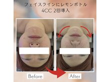 美ネージュの雰囲気（【韓国肌管理】気になるフェイスライン・たるみケアに☆）