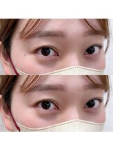 アンリミテッド(Unlimited)/まつ毛パーマ（パリジェンヌ