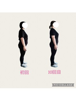 フォーシー(4C)/Before /After