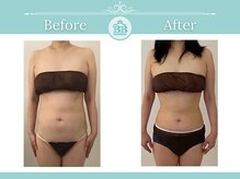 美人バスト 犬山店/【お腹引き締め】症例