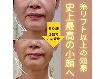 目元 口元のたるみ 眉間シワ改善専門サロン