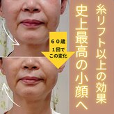 目元 口元のたるみ 眉間シワ改善専門サロン