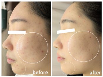 ラミーユ(La Miu)/