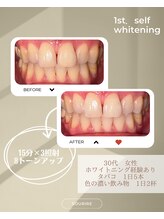 スリール(sourire)/