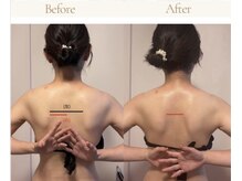 マシェリ(ma-che'rie)/3D肩甲骨剥がし+デコルテほぐし