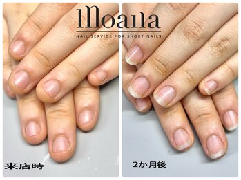 モアナ 池袋(MOANA)/弄り癖がなくなりました♪