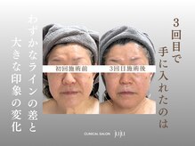 【小顔・たるみ・肌質改善 専門】clinical salon juju〔ジュジュ〕