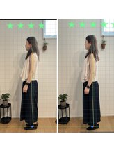 そまのや/姿勢分析とビフォーアフター