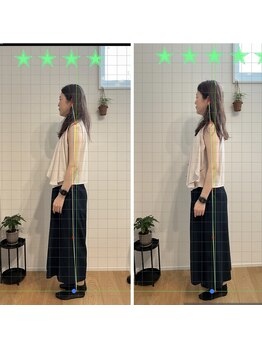 そまのや/姿勢分析とビフォーアフター