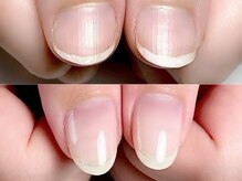 ツバキ(Tsubaki)の雰囲気（自爪育成で驚きの変化！深爪、薄爪、二枚爪などのお悩みも解消♪）