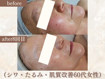スリーエッセンス(3THREE ESSENCE)の写真/【幹細胞エクソソーム美容で本格エイジングケア】初回￥8000～年齢による様々な、お悩みを根本から解決へ！