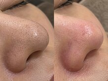 ルナ クレッシェンテ(Luna crescente)の雰囲気（毛穴悩みなら当サロンへ◎毛穴悩みの負のループを解消！[三田市]）