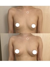 IBC 上大岡店/Before-After