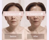 ケービューティー 小顔(K-beauty)