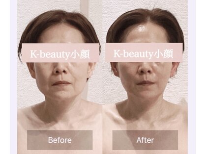 ケービューティー 小顔(K-beauty)の写真