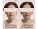 ケービューティー 小顔(K-beauty)の写真