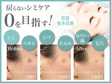 シミケアゼロ美人 表参道店(シミケアZERO美人)