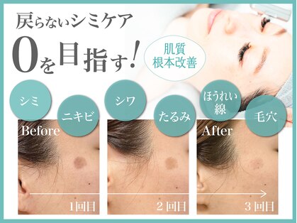 シミケアゼロ美人 表参道店(シミケアZERO美人)の写真
