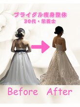 リリーフ(Re:lief)/ブライダル痩身整体