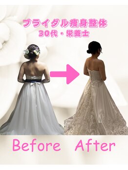 リリーフ(Re:lief)/ブライダル痩身整体