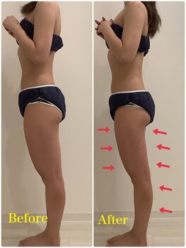 スペチアーレ 夙川/浮腫みや冷え性解消