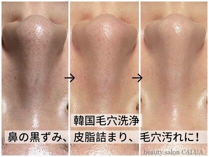 カルア(CALUA)の写真