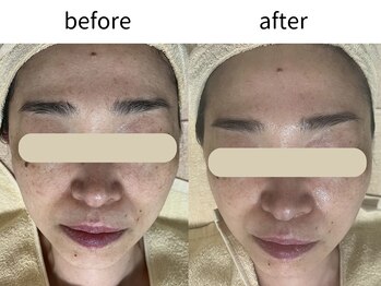 マイルーム(my room)/【before/after】