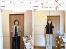 ひびき鍼灸院 整骨院/AI姿勢分析