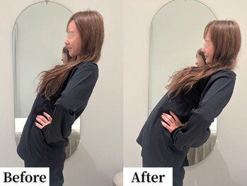 ソレア(Solea)/腰痛改善