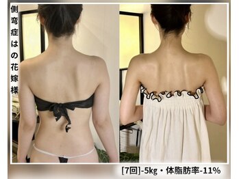 蒼(so)の写真/実績3万人超え！何をしてもキレイに痩せない原因は→諸悪の根源は歪みに！？最高の華奢感は歪みの改善!!!