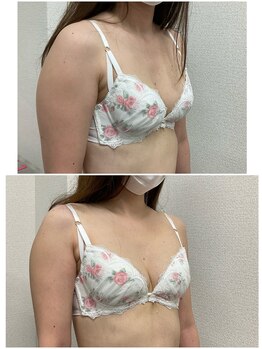 バーディー(BIRDIE)/施術1回/30代