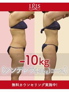 アイリスエステサロン 江州店/ビフォーアフター【2】