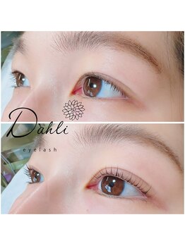 ダリ アイラッシュ(Dahli eyelash)/ラッシュリフト（まつげパーマ）