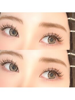 リングス(Riings)/