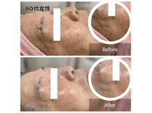 ルシアル(LUCIALL)