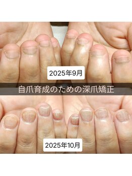 マニエネイル(mani e nail)/1ヶ月半の自爪育成ストーリー