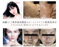ソアム(Soame)