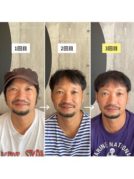 東京デトックス/男前フェイシャル3回