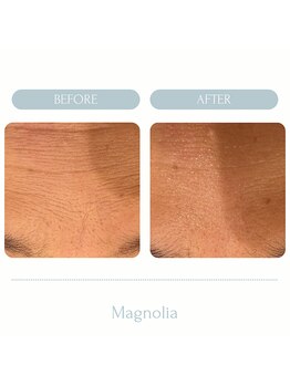 マグノリア(Magnolia)/